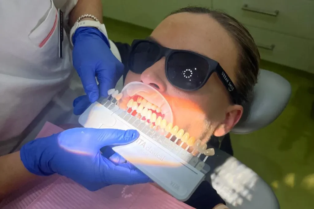An Urban Smile patient getting her teeth shade matched during her in-chair teeth whitening appointment