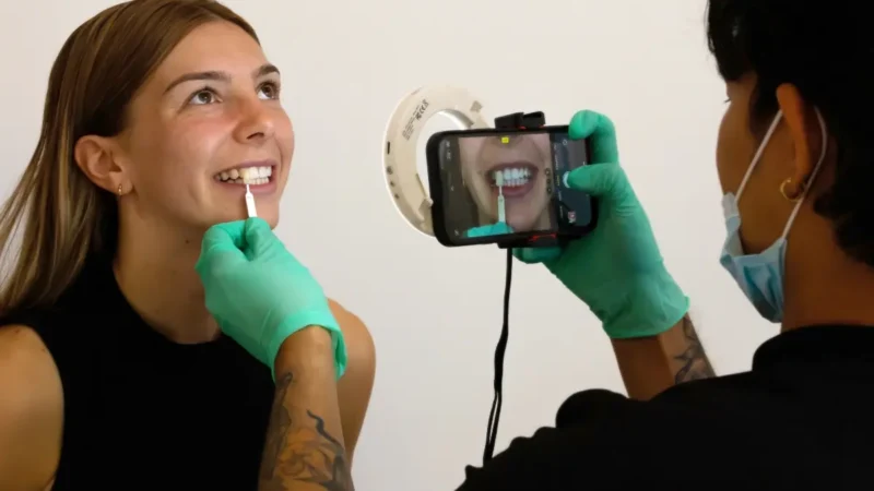 Patient getting shade matched during in-chair whitening at Urban Smile