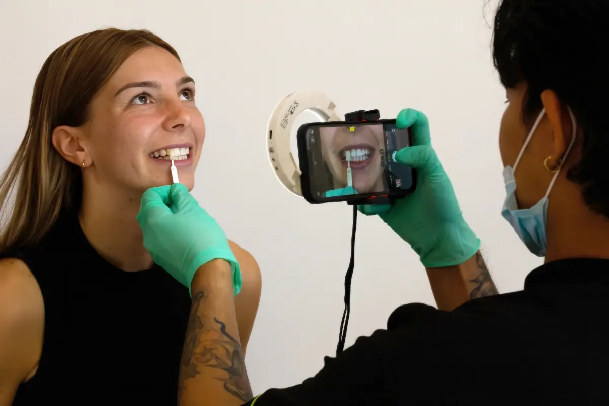 Patient getting shade matched during in-chair whitening at Urban Smile