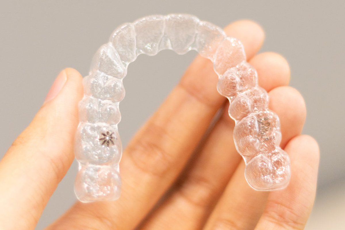 Can clear aligners fix an overbite? - SmilePath NZ