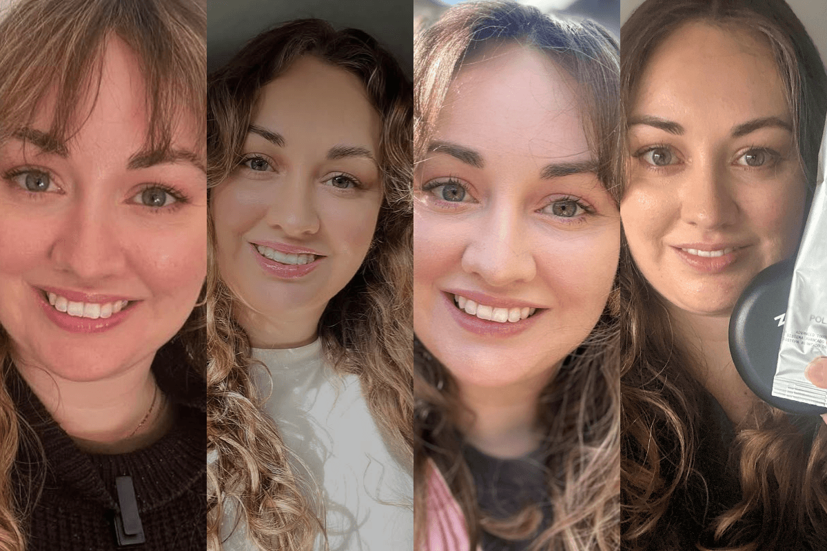 Photos of Megan throughout her clear aligner journey at Urban Smile