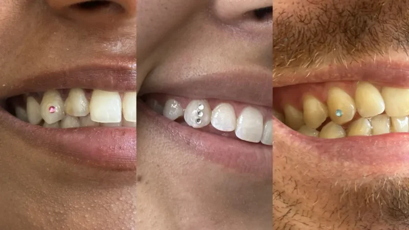 Grid of 3 smiles with tooth gems in rose, aquamarine and crystal