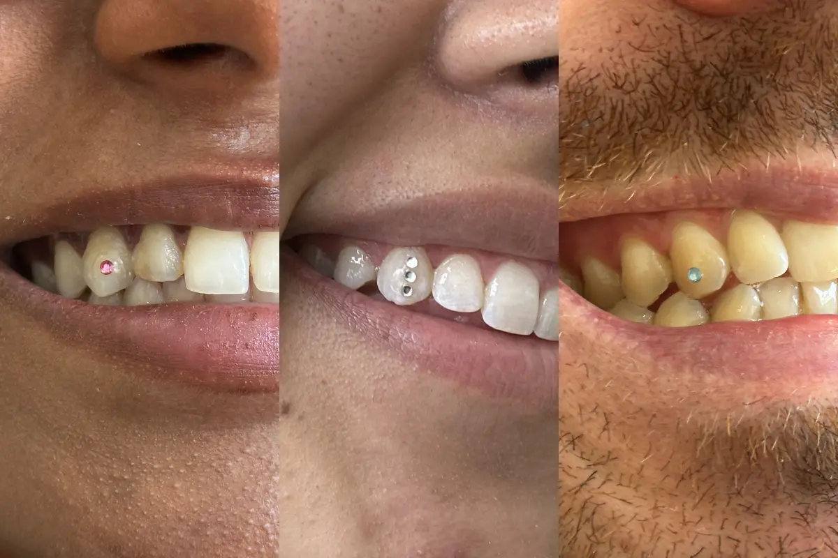 Grid of 3 smiles with tooth gems in rose, aquamarine and crystal